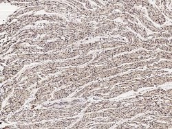 Invitrogen RCAS1 Polyclonal Antibody 100 &mu;L; Unconjugated:Antibodies,