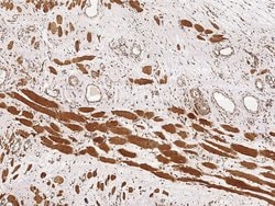 Invitrogen RCAS1 Polyclonal Antibody 100 &mu;L; Unconjugated:Antibodies,