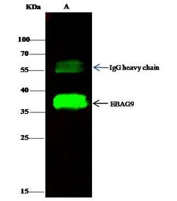 Invitrogen RCAS1 Polyclonal Antibody 100 &mu;L; Unconjugated:Antibodies,