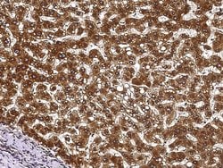 Invitrogen ECH1 Polyclonal Antibody 100 &mu;L; Unconjugated:Antibodies,