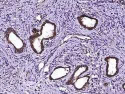 Invitrogen ECH1 Polyclonal Antibody 100 &mu;L; Unconjugated:Antibodies,