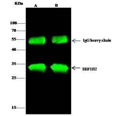 Invitrogen EEF1B2 Polyclonal Antibody 100 &mu;L; Unconjugated:Antibodies,