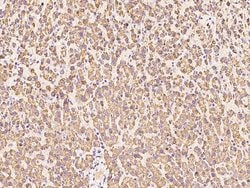 Invitrogen ENPP2 Polyclonal Antibody 100 &mu;L; Unconjugated:Antibodies,