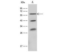Invitrogen CD39 Polyclonal Antibody 100 &mu;L; Unconjugated:Antibodies,