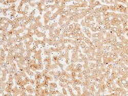 Invitrogen ENTPD5 Polyclonal Antibody 100 &mu;L; Unconjugated:Antibodies,