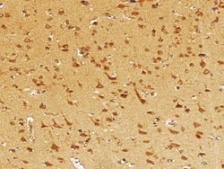 Invitrogen EphB3 Polyclonal Antibody 100 &mu;L; Unconjugated:Antibodies,
