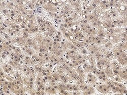 Invitrogen EphB3 Polyclonal Antibody 100 &mu;L; Unconjugated:Antibodies,