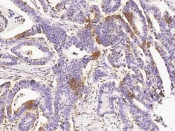Invitrogen EphB3 Polyclonal Antibody 100 &mu;L; Unconjugated:Antibodies,