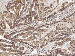 Invitrogen EphB3 Polyclonal Antibody 100 &mu;L; Unconjugated:Antibodies,