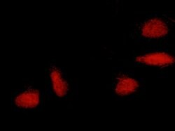 Invitrogen ERCC8 Polyclonal Antibody 100 &mu;L; Unconjugated:Antibodies,