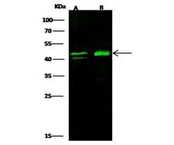 Invitrogen ERCC8 Polyclonal Antibody 100 &mu;L; Unconjugated:Antibodies,