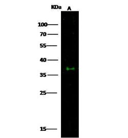 Invitrogen ESAM Polyclonal Antibody 100 &mu;L; Unconjugated:Antibodies,