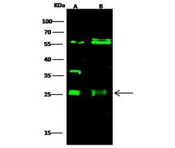 Invitrogen ETHE1 Polyclonal Antibody 100 &mu;L | Buy Online | Invitrogen&trade; | Fisher Scientific