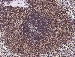 Invitrogen ETV5 Polyclonal Antibody 100 &mu;L; Unconjugated:Antibodies,