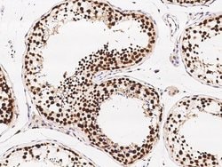 Invitrogen ETV5 Polyclonal Antibody 100 &mu;L; Unconjugated:Antibodies,
