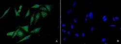 Invitrogen FANCC Polyclonal Antibody 100 &mu;L; Unconjugated:Antibodies,