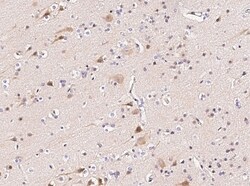 Invitrogen FANCC Polyclonal Antibody 100 &mu;L; Unconjugated:Antibodies,