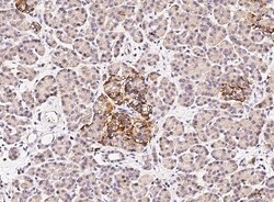 Invitrogen FANCC Polyclonal Antibody 100 &mu;L; Unconjugated:Antibodies,