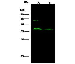 Invitrogen CD23 Polyclonal Antibody 100 &mu;L; Unconjugated:Antibodies,