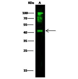Invitrogen CD64 Polyclonal Antibody 100 &mu;L; Unconjugated:Antibodies,