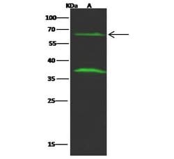 Invitrogen FCRL2 Polyclonal Antibody 100 &mu;L; Unconjugated:Antibodies,