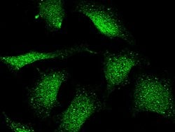 Invitrogen FHIT Polyclonal Antibody 100 &mu;L; Unconjugated:Antibodies,