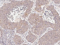 Invitrogen FHIT Polyclonal Antibody 100 &mu;L; Unconjugated:Antibodies,