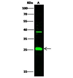 Invitrogen FKBP7 Polyclonal Antibody 100 &mu;L; Unconjugated:Antibodies,