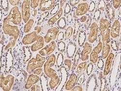 FRMPD2 Polyclonal Antibody:Antibodies, Polyclonal