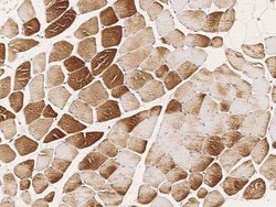 Invitrogen SLK Polyclonal Antibody 100 &mu;L; Unconjugated:Antibodies,