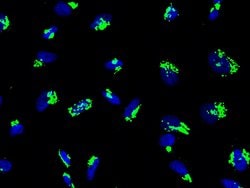 Invitrogen GALNT2 Polyclonal Antibody 100 &mu;L; Unconjugated:Antibodies,