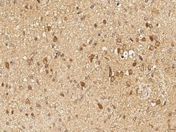 Invitrogen GALNT2 Polyclonal Antibody 100 &mu;L; Unconjugated:Antibodies,