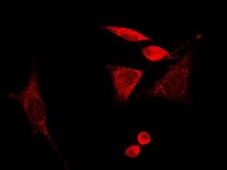 Invitrogen GMFB Polyclonal Antibody 100 &mu;L; Unconjugated:Antibodies,