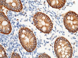Invitrogen A33 Polyclonal Antibody 100 &mu;L; Unconjugated:Antibodies,