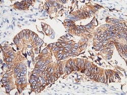 Invitrogen A33 Polyclonal Antibody 100 &mu;L; Unconjugated:Antibodies,