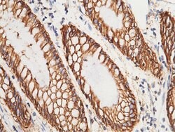 Invitrogen A33 Polyclonal Antibody 100 &mu;L; Unconjugated:Antibodies,