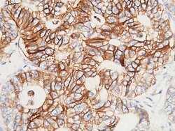 Invitrogen A33 Polyclonal Antibody 100 &mu;L; Unconjugated:Antibodies,