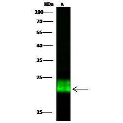 Invitrogen GPX1 Polyclonal Antibody 100 &mu;L; Unconjugated:Antibodies,