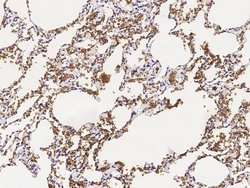Invitrogen CD235a Polyclonal Antibody 100 &mu;L | Buy Online | Invitrogen&trade; | Fisher Scientific