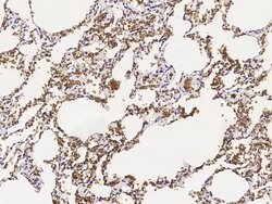 Invitrogen CD235a Polyclonal Antibody 100 &mu;L | Buy Online | Invitrogen&trade; | Fisher Scientific