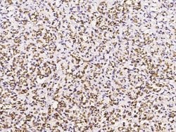 Invitrogen CD235a Polyclonal Antibody 100 &mu;L | Buy Online | Invitrogen&trade; | Fisher Scientific