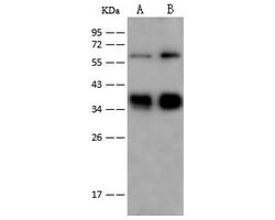 Invitrogen GYPC Polyclonal Antibody 100 &mu;L | Buy Online | Invitrogen&trade; | Fisher Scientific