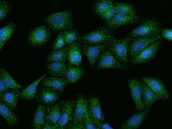 Invitrogen HGF Polyclonal Antibody 100 &mu;L; Unconjugated:Antibodies,
