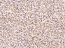 Invitrogen HGF Polyclonal Antibody 100 &mu;L; Unconjugated:Antibodies,