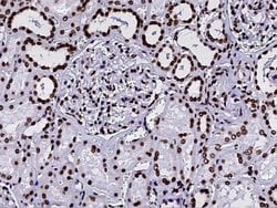 Invitrogen HIST2H2BE Polyclonal Antibody 100 &mu;L | Buy Online | Invitrogen&trade; | Fisher Scientific