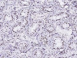 Invitrogen HIST2H2BE Polyclonal Antibody 100 &mu;L | Buy Online | Invitrogen&trade; | Fisher Scientific