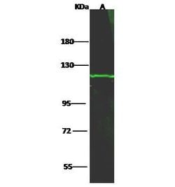 Invitrogen HK1 Polyclonal Antibody 100 &mu;L; Unconjugated:Antibodies,