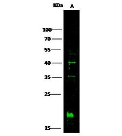 IL10RB Polyclonal Antibody:Antibodies, Polyclonal