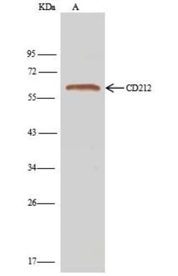 Invitrogen IL12RB1 Polyclonal Antibody 100 &mu;L; Unconjugated:Antibodies,