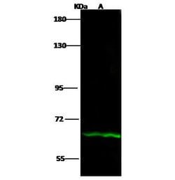 Invitrogen IL12RB1 Polyclonal Antibody 100 &mu;L; Unconjugated:Antibodies,